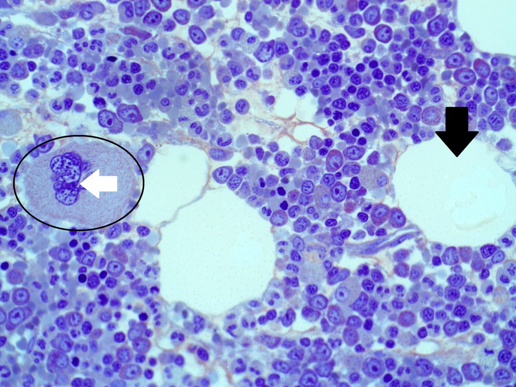 Medula Óssea Vermelha – Histologia Interativa