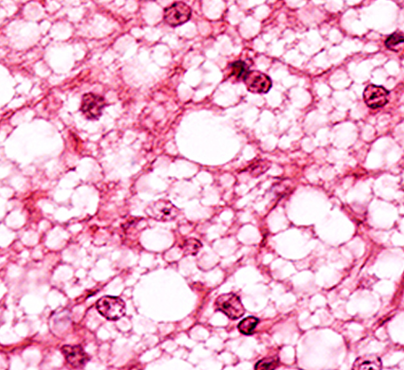 Tecido Adiposo Histologia Interativa